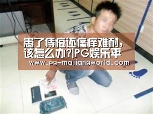 患了痔疮还瘙痒难耐，该怎么办?|PG娱乐平台